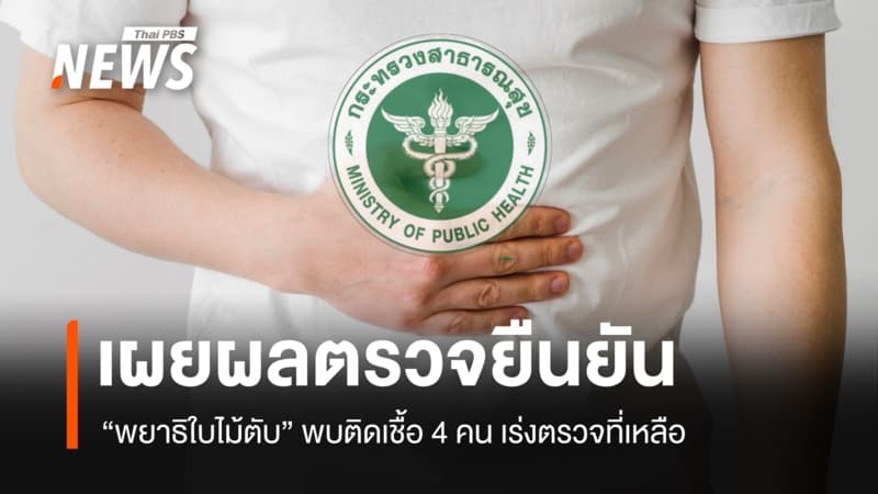 เผยผลตรวจยืนยัน "พยาธิใบไม้ตับ" พบติดเชื้อ 4 คน เร่งตรวจตัวอย่างที่เหลือ