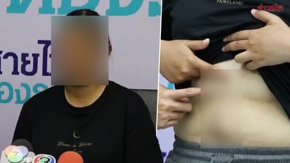 สาวร้อง สายไหมต้องรอด หมอ รพ.ดัง ผ่าตัดพลาด ผ่าตัดนิ่วในถุงน้ำดี แต่ไปตัดท่อน้ำดี!