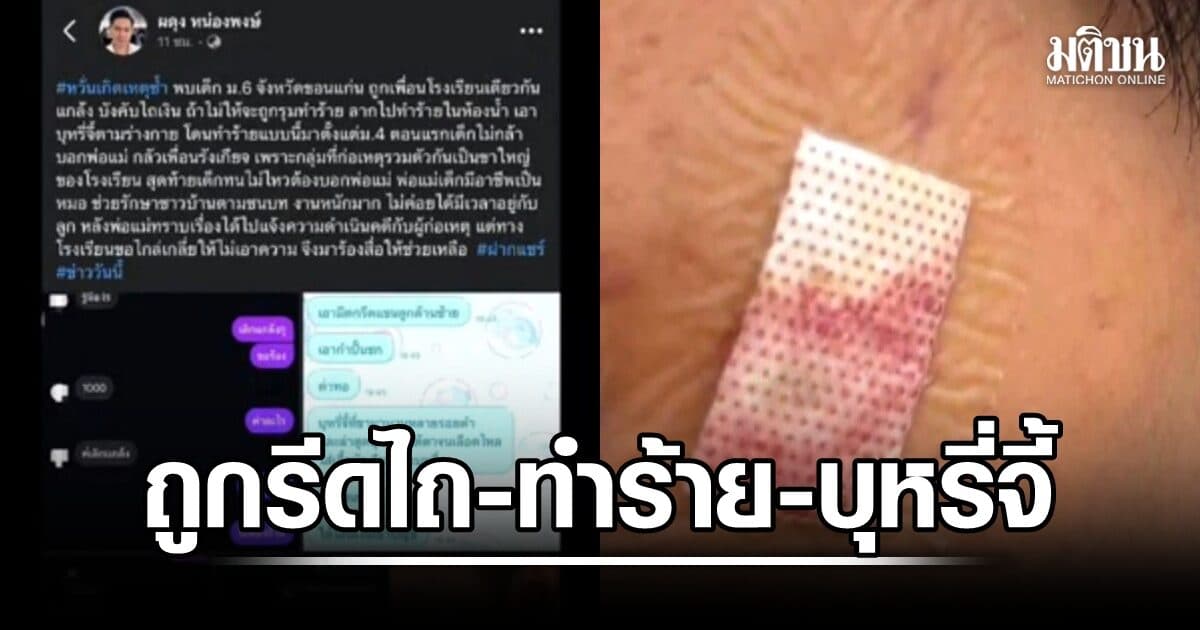 ผู้ปกครองร้อง ลูก ม.6 ร.ร.ในขอนแก่น ถูกเพื่อนรีดไถ-ทำร้าย-บุหรี่จี้ โรงเรียนร่อนแถลงการณ์