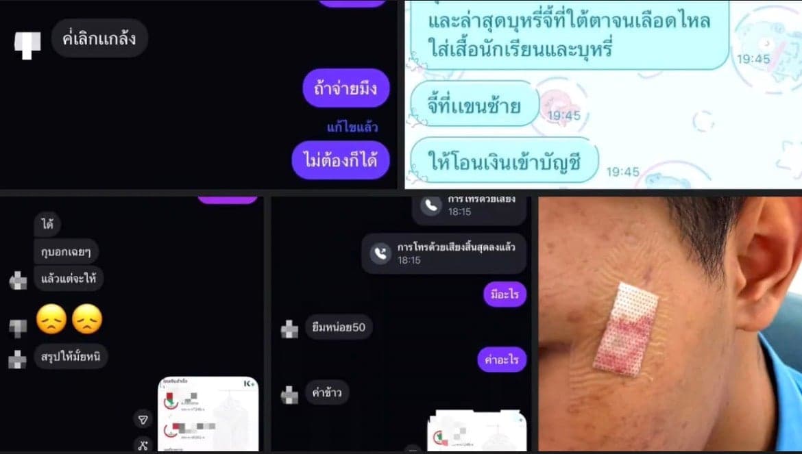 พ่อร้อนใจคดีไม่คืบ ลูกโดนหัวโจกในห้องไถเงิน – จี้บุหรี่ตามร่างกาย