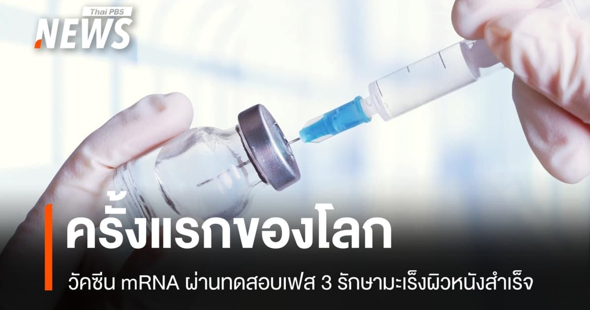 ครั้งแรกของโลก! วัคซีน mRNA ผ่านทดสอบเฟส 3 รักษามะเร็งผิวหนังสำเร็จ