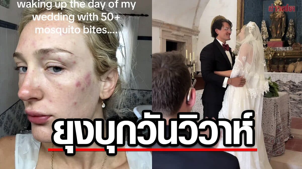 เจ้าสาวสหรัฐฯ เจอรอยยุงกัดกว่า 50 จุดวันแต่งงาน ต้องลุ้นช่างภาพเก่งโฟโตชอป