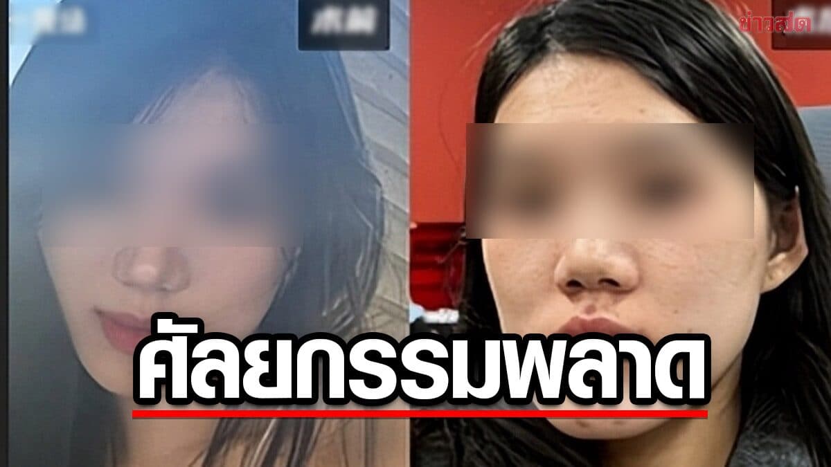สุดช้ำ! สาวจีนวัย 24 ขอผ่าตัดแก้กรามยื่นเพียงเล็กน้อย แต่จบด้วยใบหน้าผิดรูป