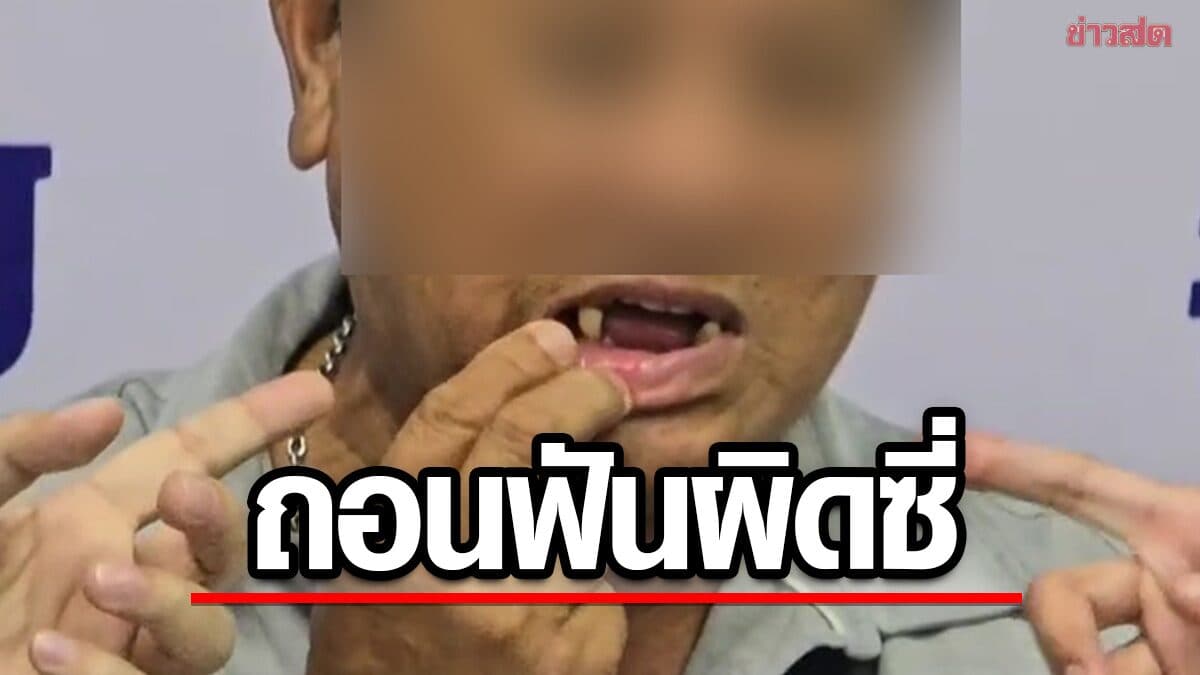 คุณลุงวัย 64 ปี ร้อง หมอคลินิกดัง ถอนฟันผิดซี่ ส่งผลให้เคี้ยวข้าวลำบาก