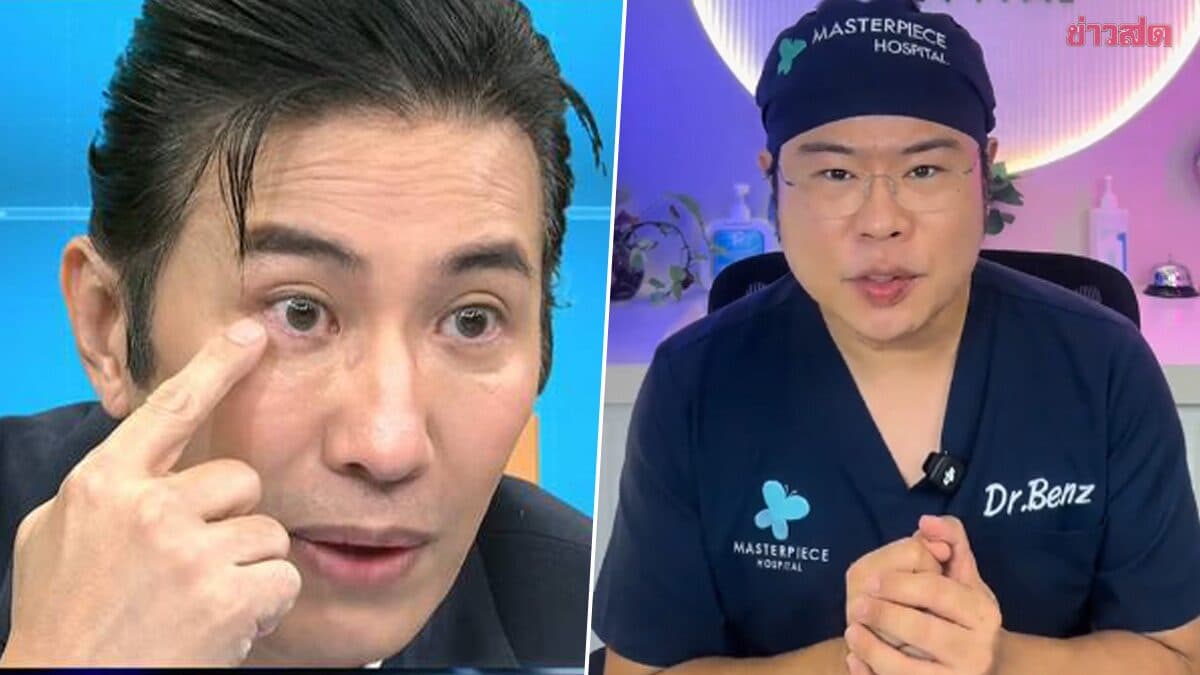 หมอเบ็นซ์ เตือนภัย หลัง หนุ่ม กรรชัย มีเนตรวงแหวน มักพบในผู้ชาย เสี่ยงโรคเส้นเลือดหัวใจ-สโตรก