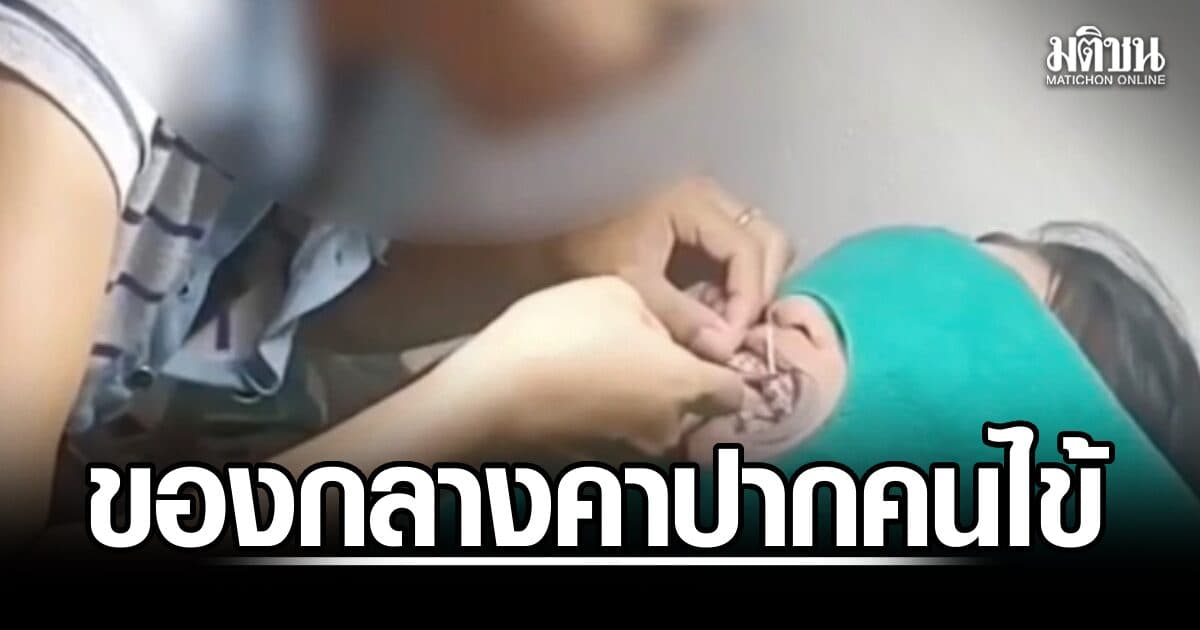 ของกลางคาปาก! ตำรวจบุกทลาย ‘หมอเถื่อน’ 5 จุด เจอจัดฟัน-พิมพ์ฟันคนไข้ต่อหน้า ยึด 1,058 ชิ้น