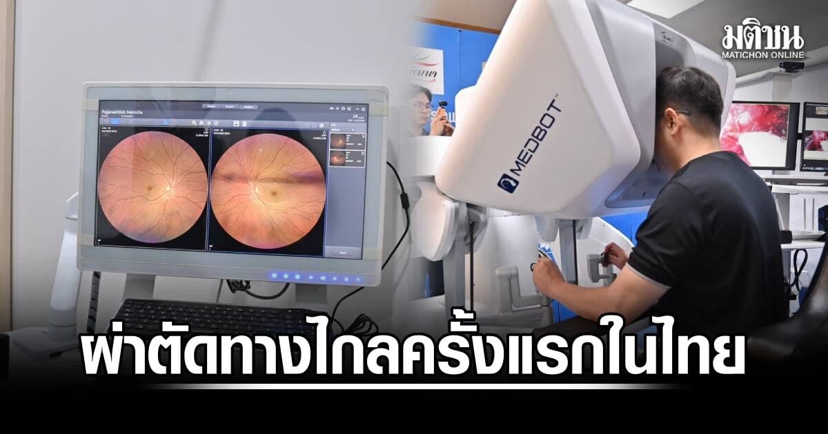 ครั้งแรกในไทย! ผ่าตัดมะเร็งต่อมลูกหมากทางไกล 250 กม. ‘รพ.นพรัตนฯ-มหาราชโคราช’ เปิดทางแพทย์ขั้นสูงสู่ภูมิภาค