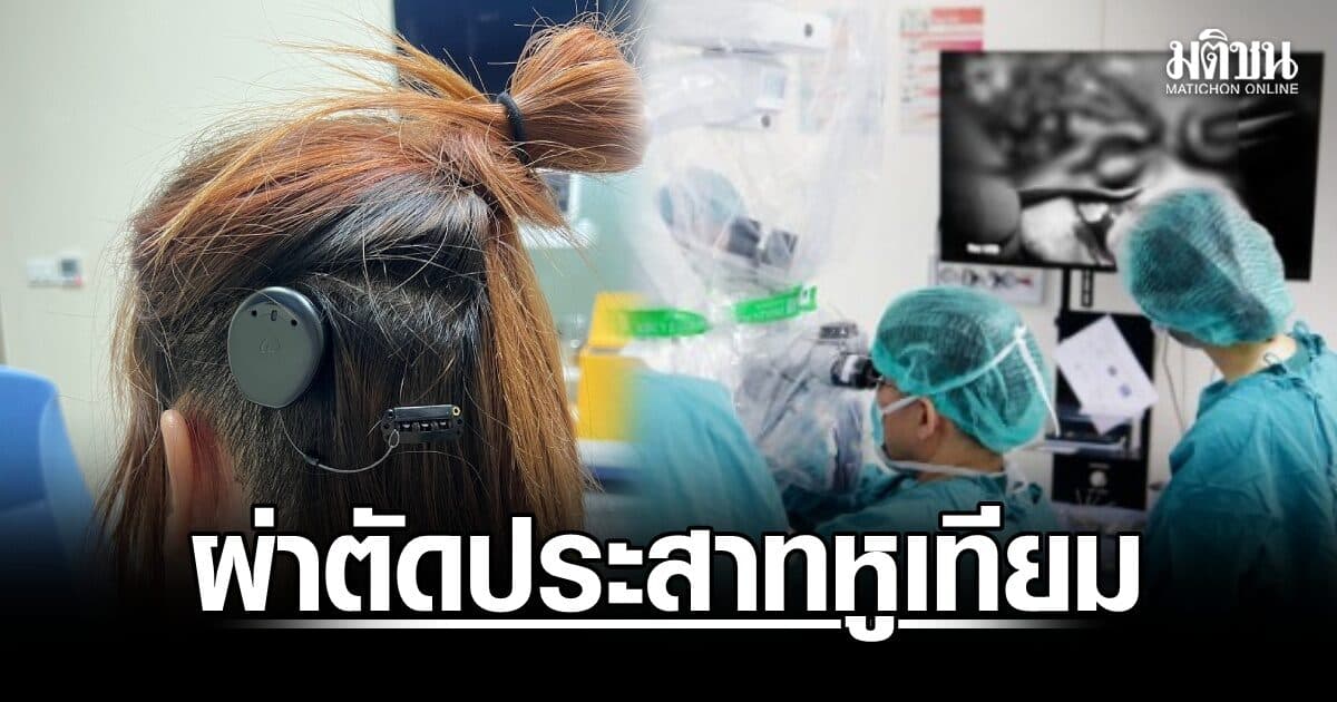 ตอกย้ำ 40 ปีแห่งความสำเร็จ! รพ. จุฬาลงกรณ์ ผู้นำการผ่าตัด ‘ประสาทหูเทียม’ รายแรกของไทย มุ่งสร้างสรรค์นวัตกรรมการได้ยินแห่งอนาคต