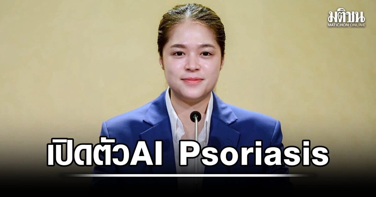 รัฐบาล เปิดตัวระบบ AI Psoriasis คัดกรองโรคสะเก็ดเงิน แม่นยำ 95 % ลดเหลื่อมล้ำบริการสุขภาพ