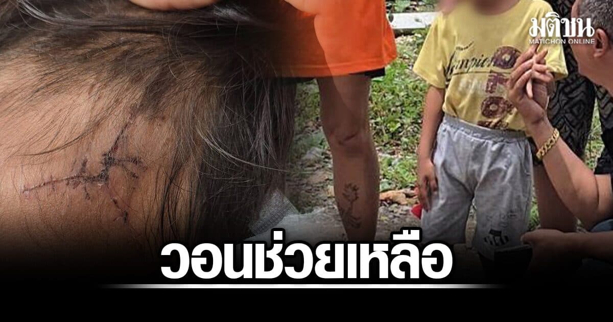 ด.ช.4ขวบ ถูกหมาขย้ำหัวเย็บกว่า 30 เข็ม เจ้าของอ้างไม่มีเงิน ขอจ่าย 500 บาท พร้อมขนม